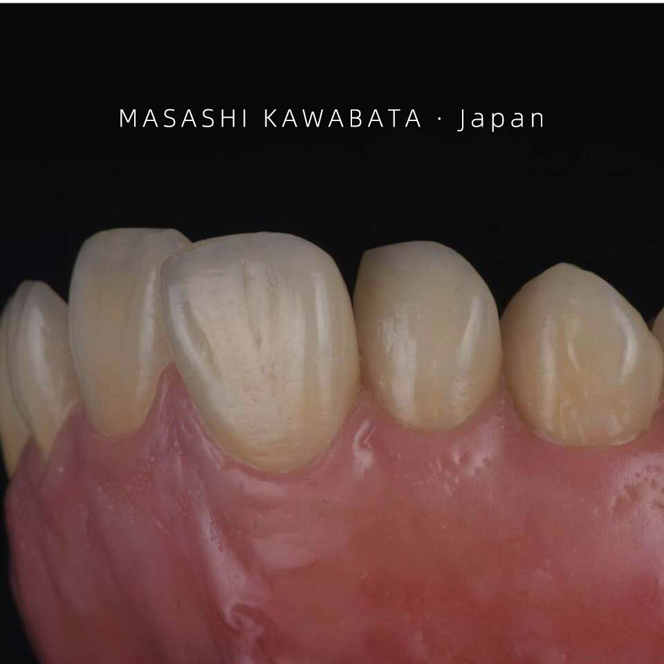Dental Ceramic Material Powder for restoration