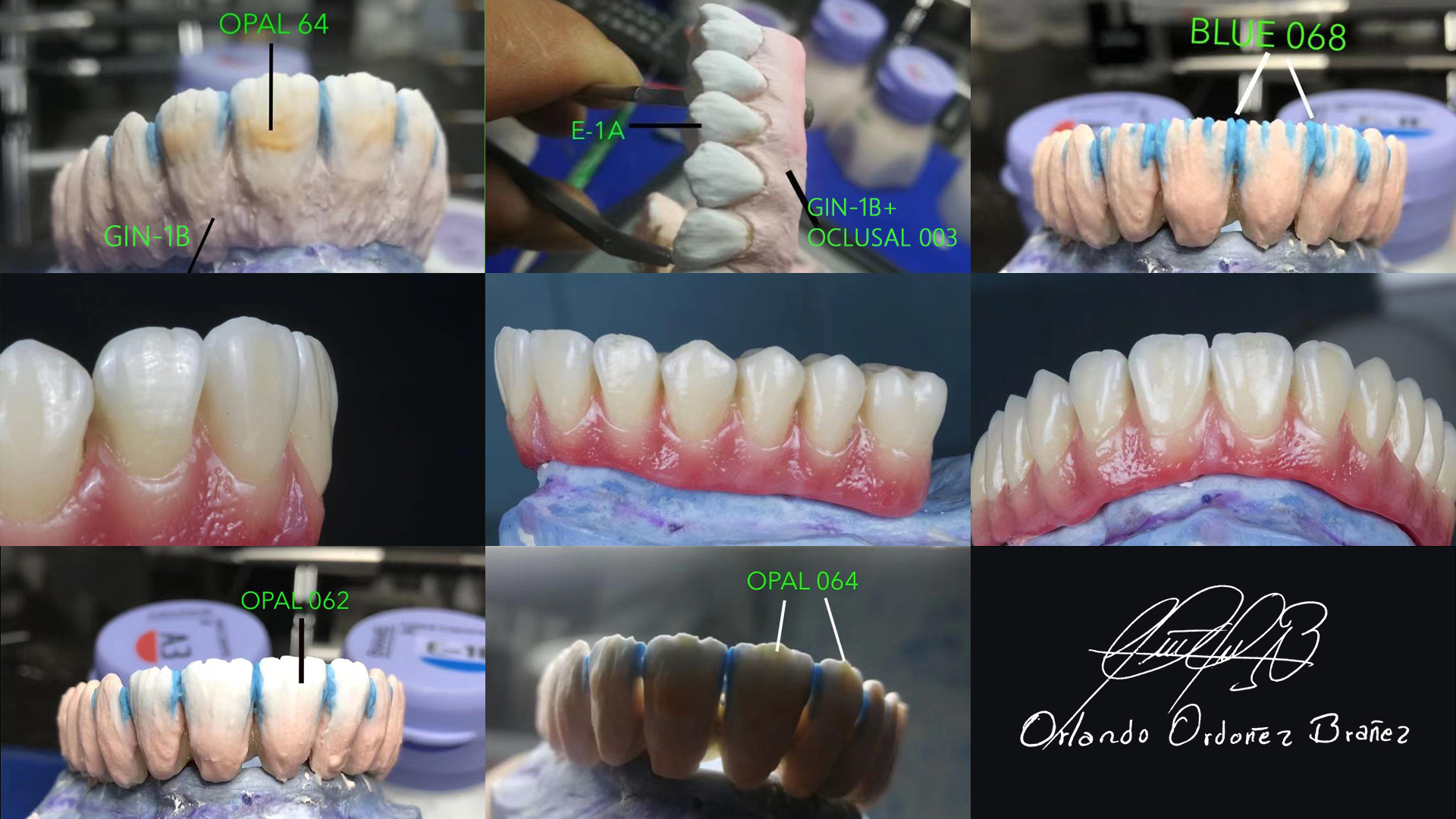 effect occlusal dental ceramic powder
