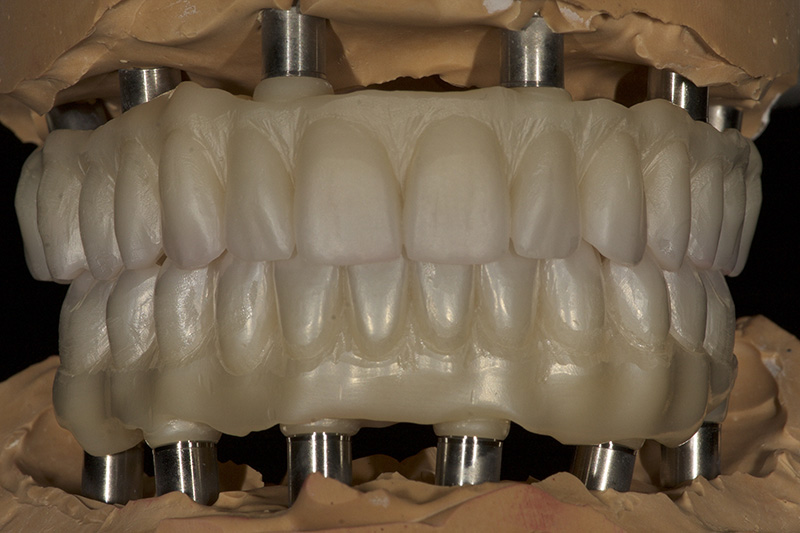 Dental Lab Material Porcelain Powder