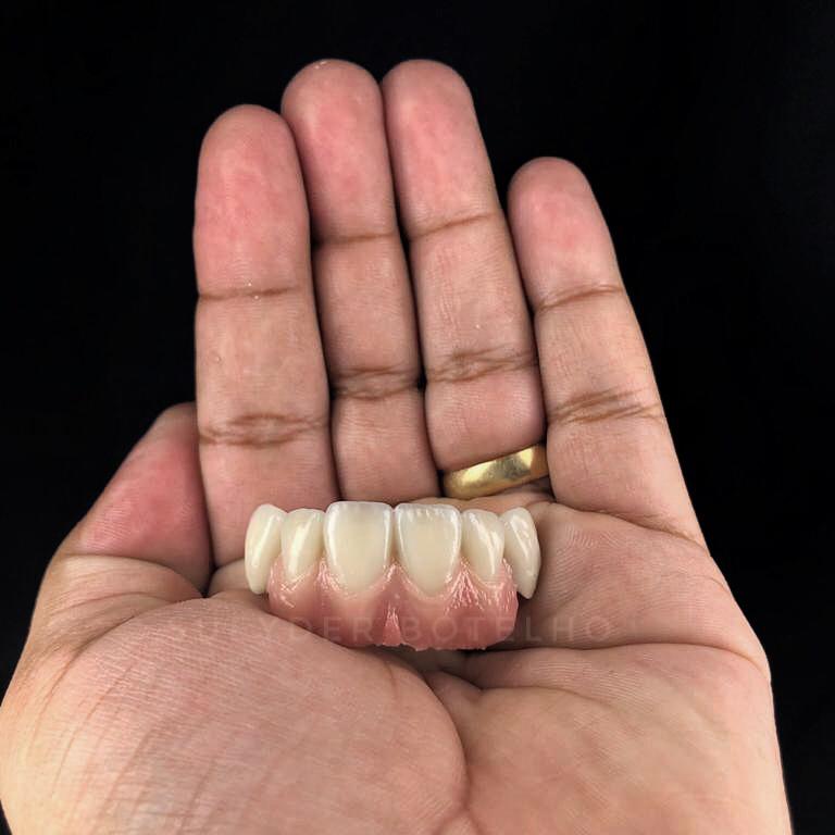 porcelain ceramic for dental lab factory porcelain ceramic for dental lab factory