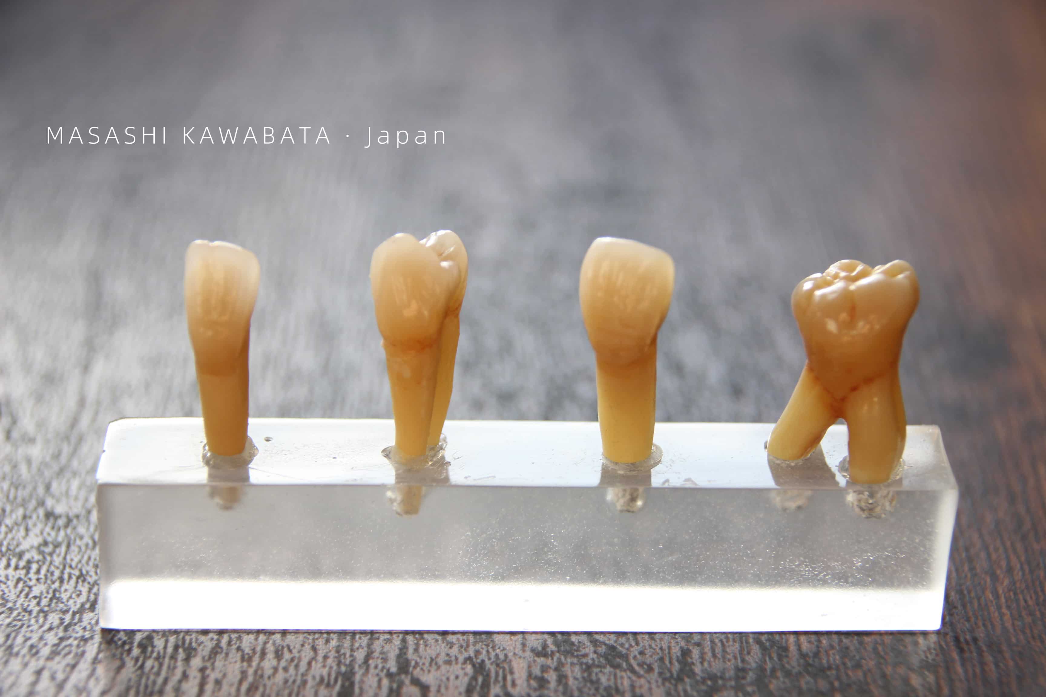 Ceramic Use for Dental Prosthesis