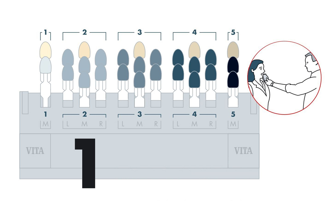 Shade guide for dental lab