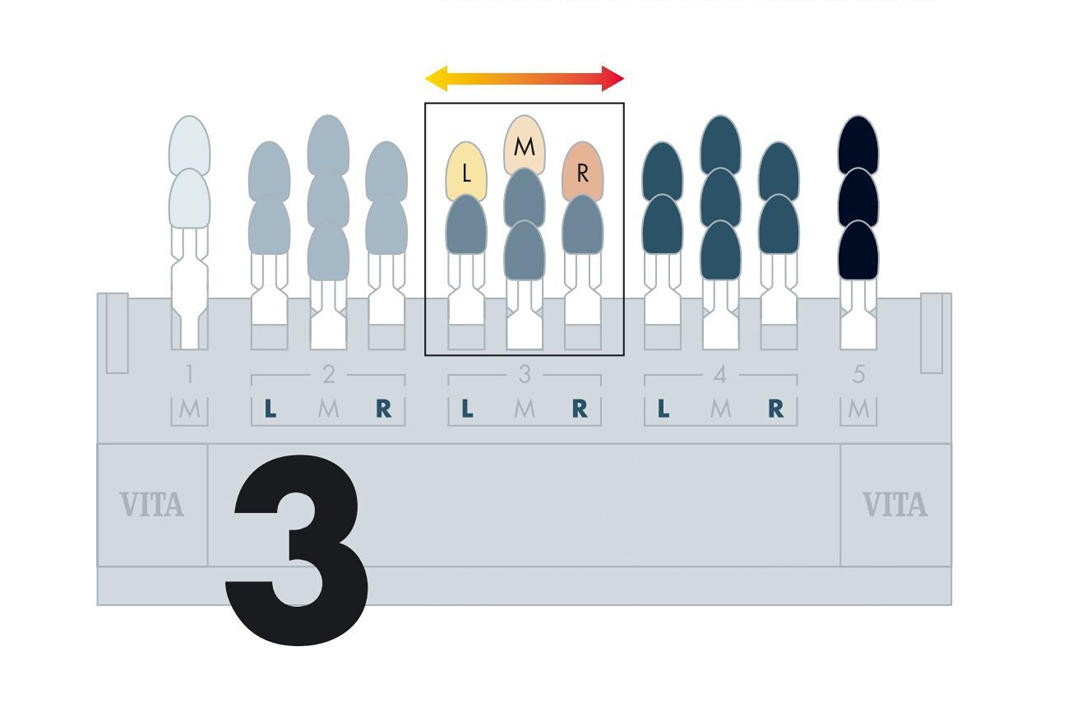 Dental ceramic vita shade guide