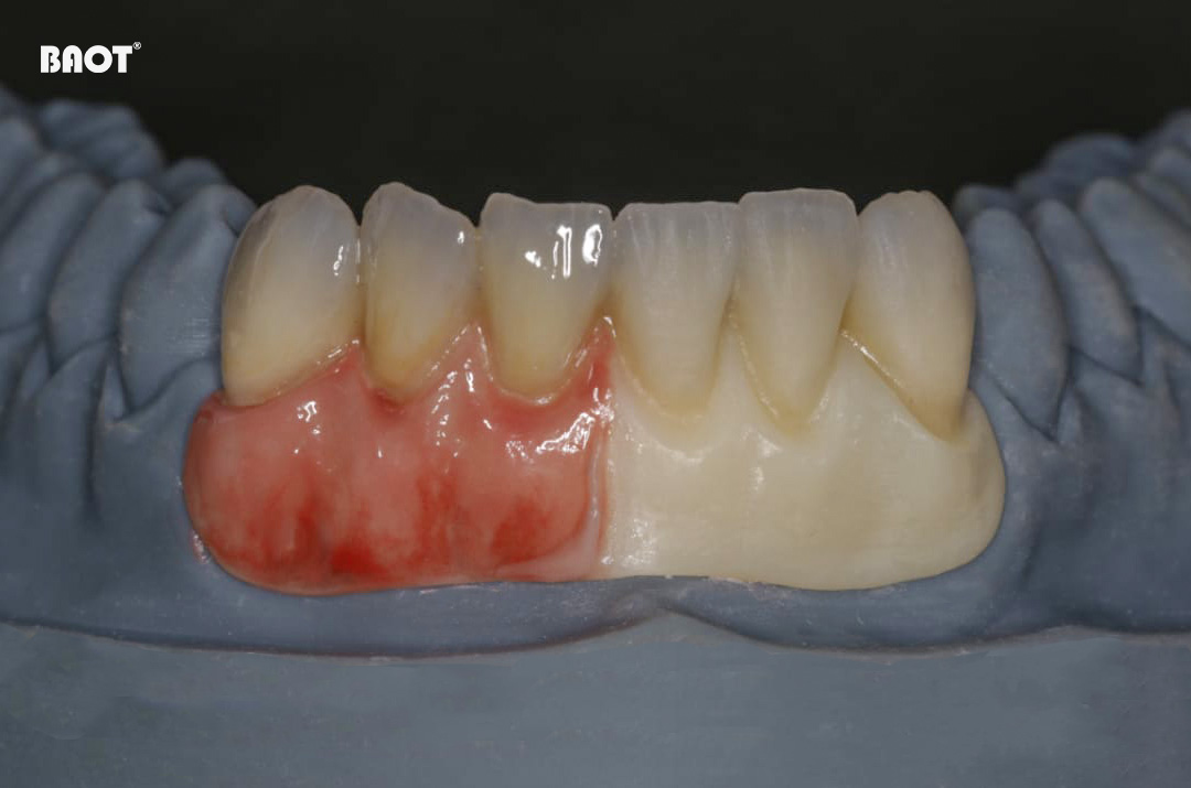 BAOT Staining Paste Dental Technique 