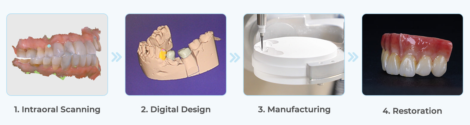 BAOT MS02 intraoral scanner integrated into a digital dental CAD/CAM workflow BAOT MS02 intraoral scanner integrated into a digital dental CAD/CAM workflow