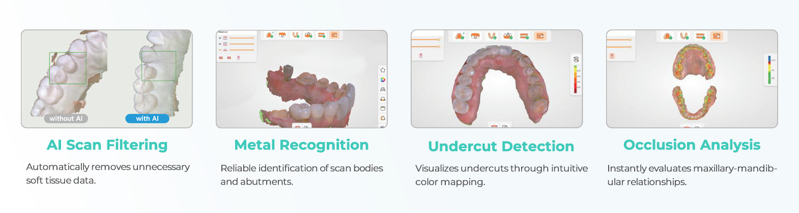 BAOT MS02 AI-assisted intraoral scanning with scan filtering, metal recognition, undercut detection, and occlusion analysis BAOT MS02 AI-assisted intraoral scanning with scan filtering, metal recognition, undercut detection, and occlusion analysis