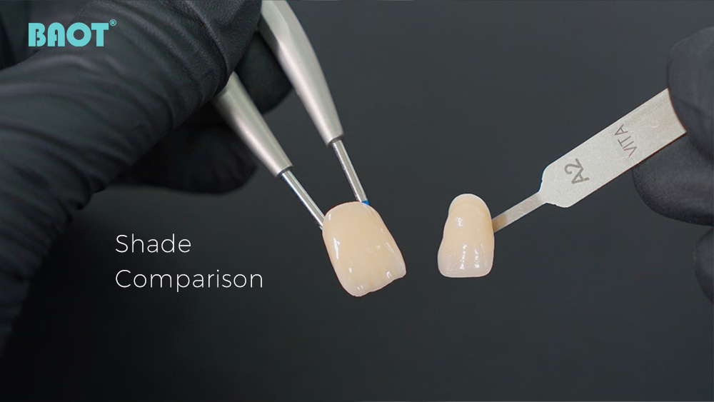 Shade comparison After Dental stain and glaze 