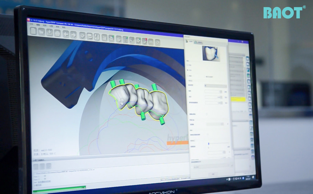 The Role of Zirconia Blocks in Digital Dentistry's Future