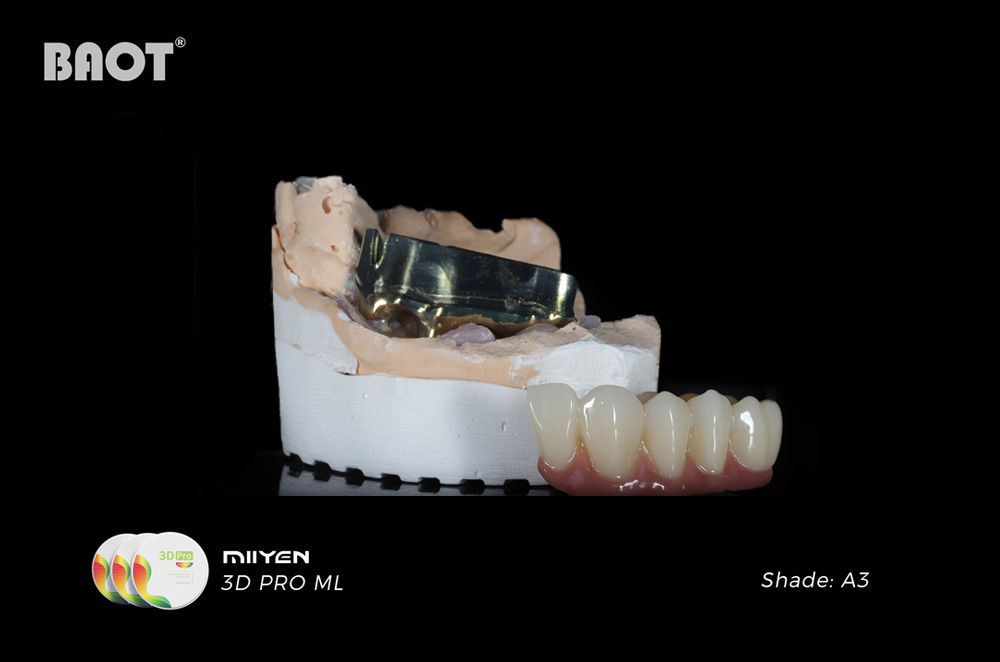 What Is a Zirconia Block? Everything Dental Professionals Need to Know
