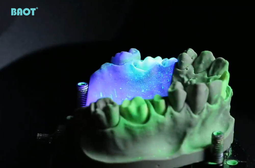 The Basic Principles and Working Mechanism of Dental Desktop Scanners