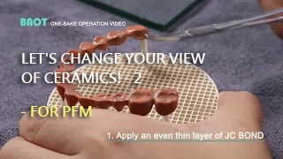 BAOT Ceramic | One-Bake Operation for PFM-2